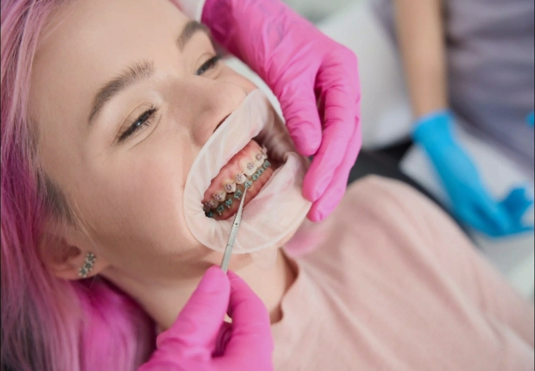 Braces & Aligners